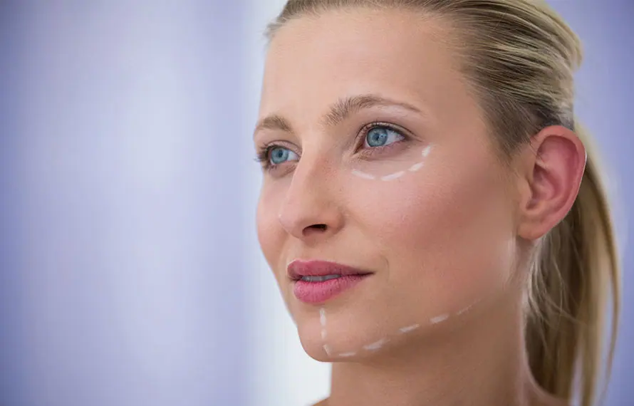 Full facelift visual from Eteris Clinic